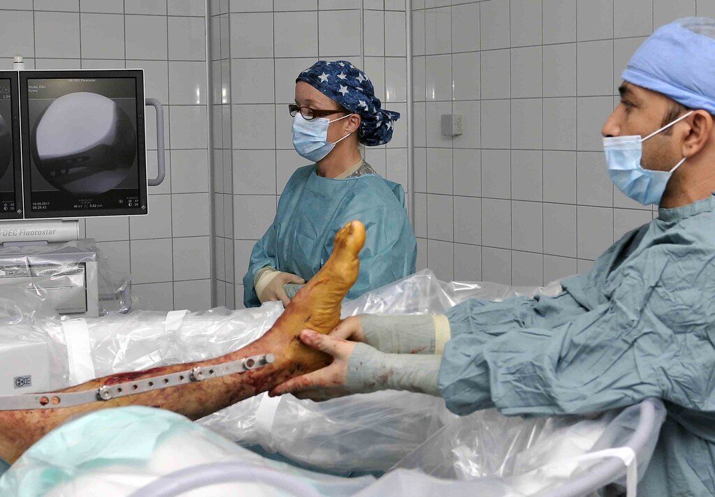 ‘Massa de osso’ impressa em 3D pode acelerar recuperação de fraturas em humanos e animais